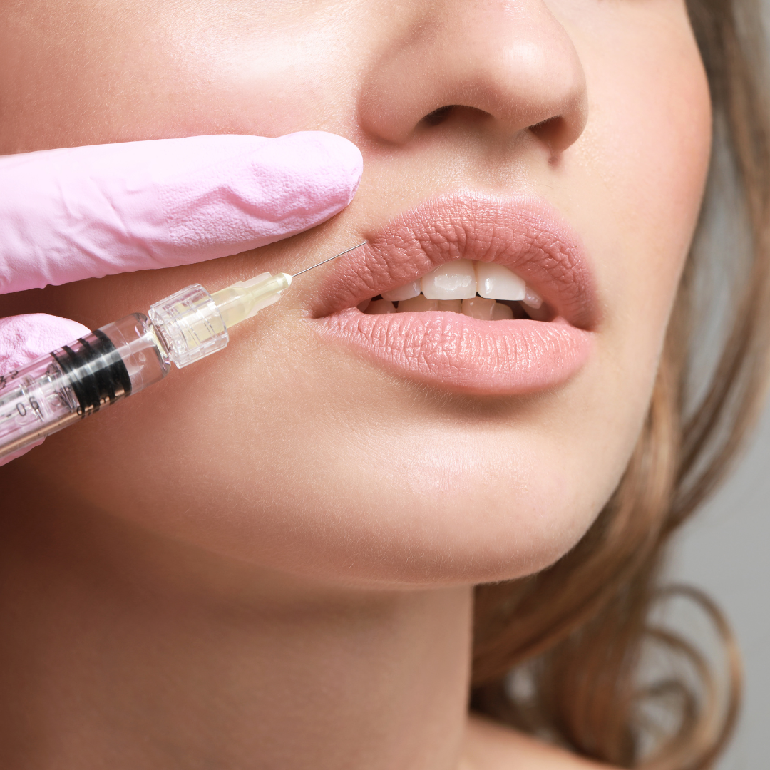 Lip Filler (1 cc Syringe)